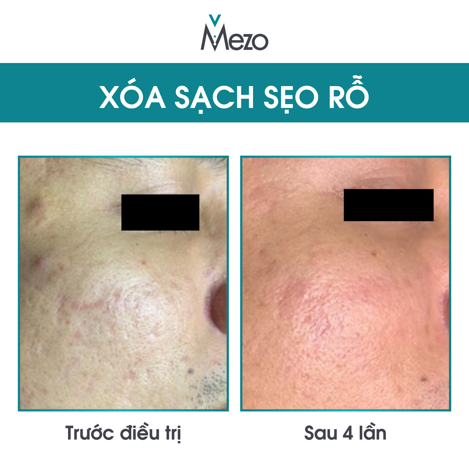 Before - After - 07.08.20-04