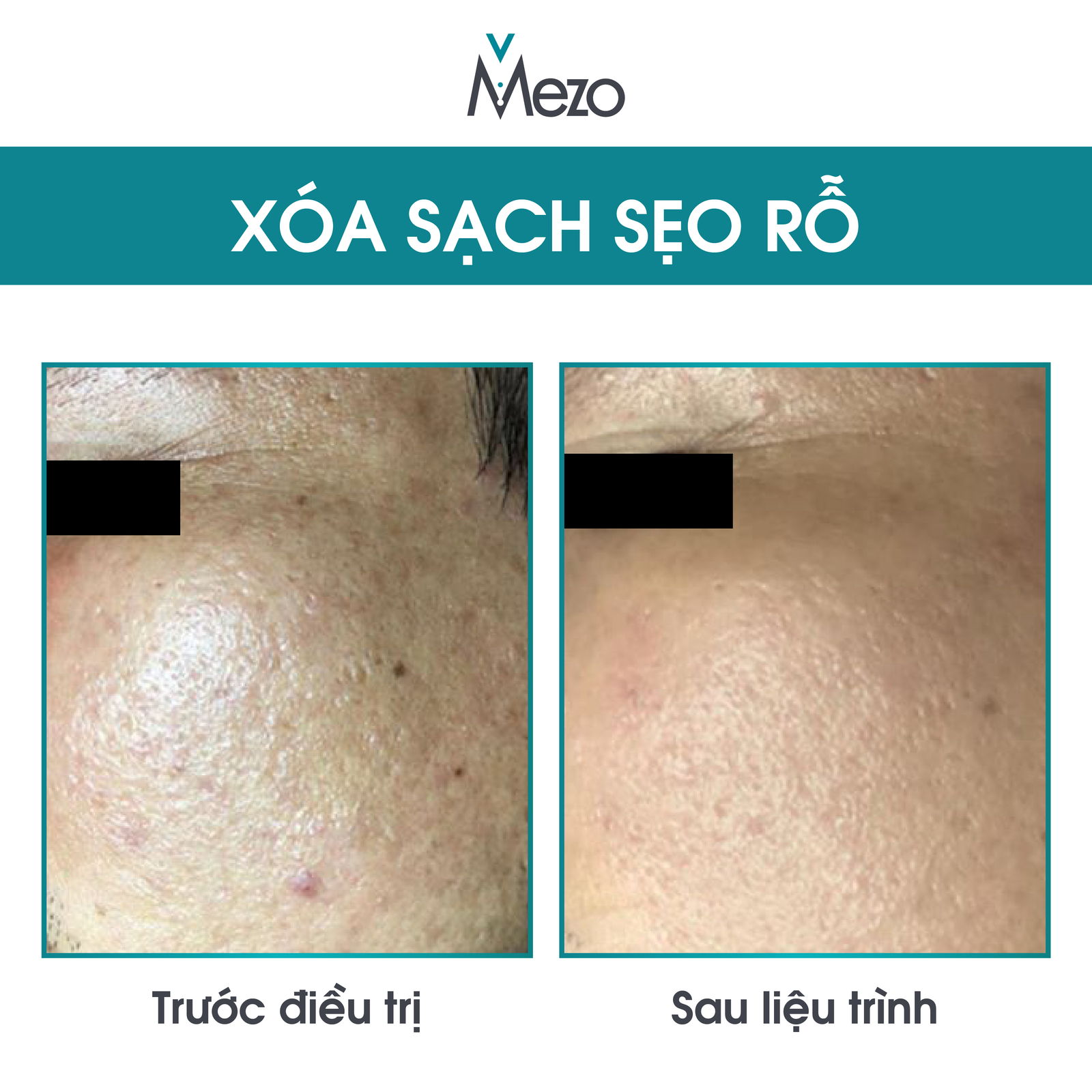 Before - After - 07.08.20-06