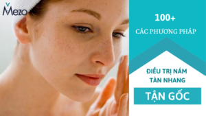 100+ Cách điều trị nám tàn nhang tận gốc